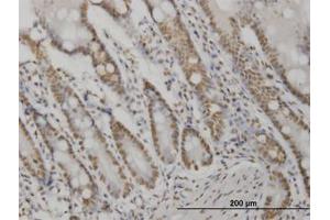 Image no. 2 for anti-V-Akt Murine Thymoma Viral Oncogene Homolog 2 (AKT2) (AA 100-189) antibody (ABIN599349) (AKT2 anticorps  (AA 100-189))
