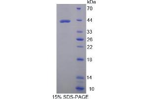 SDS-PAGE analysis of Human AST2 Protein. (GOT2 Protéine)
