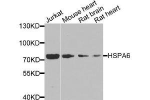 Western blot analysis of extracts of various cell lines, using HSPA6 antibody. (HSPA6 anticorps)