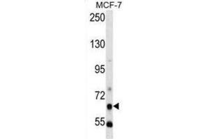 Western Blotting (WB) image for anti-phosphoenolpyruvate Carboxykinase 1 (Soluble) (PCK1) antibody (ABIN3003679) (PCK1 anticorps)