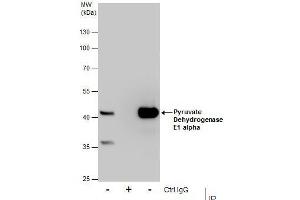 anti-Pyruvate Dehydrogenase E1 alpha (Center) antibody