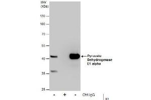 IP Image Immunoprecipitation of Pyruvate Dehydrogenase E1 alpha protein from HepG2 whole cell extracts using 5 μg of Pyruvate Dehydrogenase E1 alpha antibody, Western blot analysis was performed using Pyruvate Dehydrogenase E1 alpha antibody, EasyBlot anti-Rabbit IgG  was used as a secondary reagent. (Pyruvate Dehydrogenase E1 alpha (Center) anticorps)