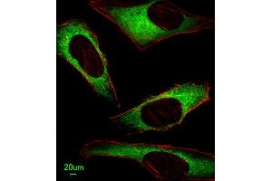 Immunofluorescent analysis of Hela cells, using IT Antibody (N-term) (ABIN651135 and ABIN2840091).