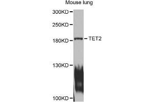 Western blot analysis of extracts of mouse lung, using TET2 antibody (ABIN1875061) at 1:1000 dilution.