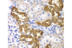 Immunohistochemistry of paraffin-embedded Rat kidney using CD151 Polyclonal Antibody at dilution of 1:200 (40x lens).