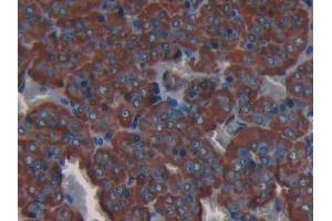 DAB staining on IHC-P; Samples: Rat Adrenal gland Tissue (COL3A1 anticorps  (AA 1171-1435))