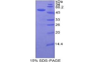 SDS-PAGE analysis of Human UPRT Protein. (Uracil Phosphoribosyltransferase (UPP) Protéine)