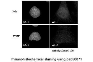Image no. 2 for anti-Ataxia Telangiectasia Mutated (ATM) (C-Term) antibody (ABIN363380) (ATM anticorps  (C-Term))