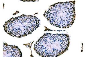 IHC analysis of RRS1 using anti-RRS1 antibody (ABIN7601344).