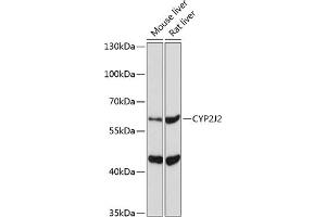 Western blot analysis of extracts of various cell lines, using CYP2J2 Antibody (ABIN6134306, ABIN6139339, ABIN6139340 and ABIN6221491) at 1:1000 dilution.