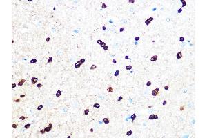 Immunohistochemistry of paraffin-embedded rat brain using TPPP/p25 Rabbit mAb (ABIN7271031) at dilution of 1:100 (40x lens). (Tppp anticorps)