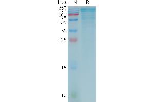 Human LGBP Protein, Flag Tag on SDS-PAGE under reducing condition.