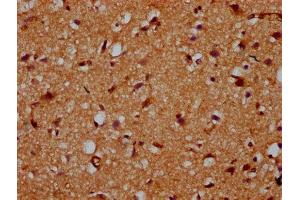 IHC image of ABIN7163112 diluted at 1:200 and staining in paraffin-embedded human brain tissue performed on a Leica BondTM system. (CDS2 anticorps  (AA 354-445))