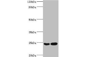Western blot All lanes: RAN antibody at 2 μg/mL Lane 1: Hela whole cell lysate Lane 2: Jurkat whole cell lysate Secondary Goat polyclonal to rabbit IgG at 1/10000 dilution Predicted band size: 24 kDa Observed band size: 24 kDa (RAN anticorps  (AA 1-216))