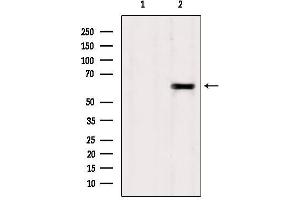 Western blot analysis of extracts from Sp2/0, using TCTN1 Antibody.