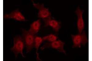 ABIN6267532 staining COS7 by IF/ICC.