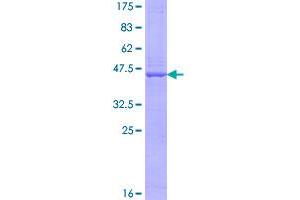 Ubiquitously-Expressed, Prefoldin-Like Chaperone (UXT) (AA 1-169) protein (GST tag)