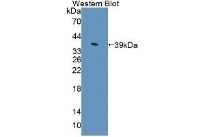Detection of Recombinant ALDH1A1, Mouse using Polyclonal Antibody to Aldehyde Dehydrogenase 1 Family, Member A1 (ALDH1A1) (ALDH1A1 anticorps  (AA 1-326))