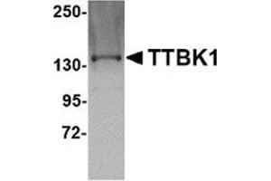 Western blot analysis of TTBK1 in Jurkat lysate with this product at 1 μg/ml. (TTBK1 anticorps  (C-Term))