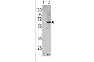 Western blot analysis of PRK (arrow) using rabbit polyclonal PRK Antibody (C-term) (R). (PRKAA2 anticorps  (C-Term))