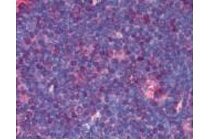 Human Thymus (formalin-fixed, paraffin-embedded) stained with TNFRSF8 antibody LS-B1865 at 5 ug/ml followed by biotinylated anti-mouse IgG secondary antibody LS-D2, alkaline phosphatase-streptavidin and chromogen.