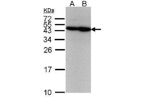 WB Image Sample(30 μg of whole cell lysate) A:293T B:A431, 12% SDS PAGE antibody diluted at 1:500