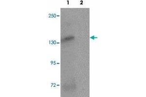 Western blot analysis of ATP2C2 in NIH/3T3 cell lysate with ATP2C2 polyclonal antibody  at 1 ug/mL in (1) the absence and (2) the presence of blocking peptide. (ATP2C2 anticorps  (N-Term))