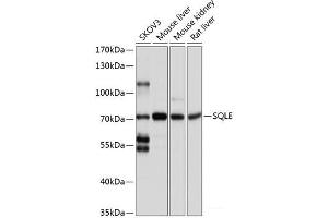 Western blot analysis of extracts of various cell lines using SQLE Polyclonal Antibody at dilution of 1:1000. (SQLE anticorps)