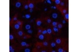 Immunofluorescence analysis of Human stomach tissue using CD23 Monoclonal Antibody at dilution of 1:200.