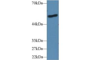 Rabbit Capture antibody from the kit in WB with Positive Control: Mouse liver tissue.
