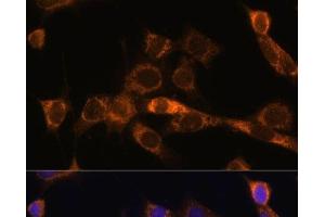 Immunofluorescence analysis of NIH/3T3 cells using FoxO3a Polyclonal Antibody at dilution of 1:100. (FOXO3 anticorps)