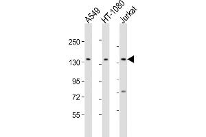 All lanes : Anti-FMN1 Antibody (Center) at 1:2000 dilution Lane 1: A549 whole cell lysate Lane 2: HT-1080 whole cell lysate Lane 3: Jurkat whole cell lysate Lysates/proteins at 20 μg per lane. (FMN1 anticorps  (AA 270-304))
