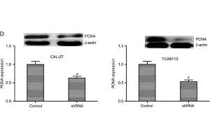 KIF20B knockdown inhibits cell proliferation.