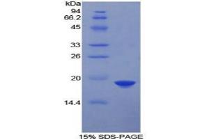SDS-PAGE analysis of Human FDFT1 Protein. (FDFT1 Protéine)