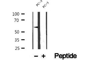 Western blot analysis of extracts of PC-3 cells, using ETV5 antibody. (ETV5 anticorps  (Internal Region))