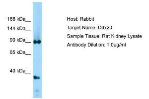 Host: Rabbit  Target Name: Ddx20  Sample Tissue: Rat Kidney lysates  Antibody Dilution: 1. (DDX20 anticorps  (Middle Region))