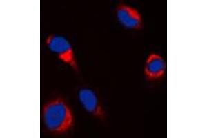 Immunofluorescent analysis of Tyrosinase staining in HepG2 cells. (TYR anticorps  (C-Term))