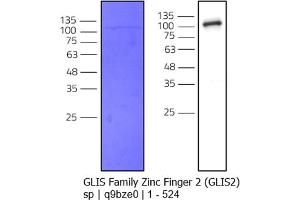 GLIS2 Protein (AA 1-524) (MBP tag,His tag)