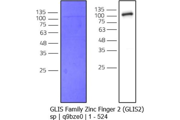 GLIS2 Protein (AA 1-524) (MBP tag,His tag)