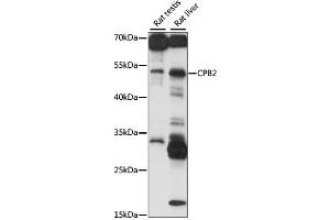 Western blot analysis of extracts of various cell lines, using CPB2 antibody (ABIN6293650) at 1:1000 dilution. (CPB2 anticorps)