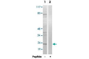 Western blot analysis of extracts from LoVo cells, using EIF4E3 polyclonal antibody .