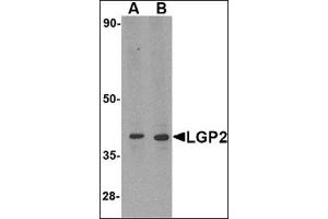 Western blot analysis of LGP2 in MDA-MB-361 cell lysate with this product at (A) 0. (DHX58 anticorps  (N-Term))