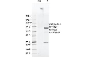 SDS-PAGE Analysis Purified FAT Mouse Monoclonal Antibody (FAT1-3D7/1). (FAT1 anticorps  (Cytoplasmic Domain))