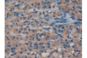 DAB staining on IHC-P; Samples: Rat Intestine Tissue (Caspase 3 anticorps  (AA 29-175))