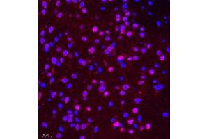 Immunofluorescence of paraffin embedded mouse brain using NSFL1C (ABIN7074865) at dilution of 1:650 (400x lens)