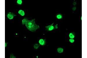 Image no. 3 for anti-T-Cell Acute Lymphocytic Leukemia 1 (TAL1) antibody (ABIN1501294) (TAL1 anticorps)