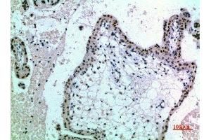Immunohistochemical analysis of paraffin-embedded human-placenta, antibody was diluted at 1:200
