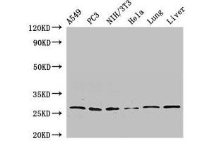 Western Blot Positive WB detected in: A549 whole cell lysate, PC-3 whole cell lysate, NIH/3T3 whole cell lysate, Hela whole cell lysate, Rat lung tissue, Mouse liver tissue All lanes: PSMA3 antibody at 2.