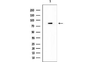Western blot analysis of lysates from COLO205 cells(heat-shock treatment), using TLR5 Mouse Monoclonal Antibody at 1/1000 dilution.