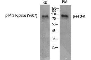 Western Blot (WB) analysis of specific cells using Phospho-PI 3-kinase p85alpha (Y607) Polyclonal Antibody.